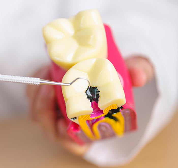 Dentist with tooth Anatomy model. Oral Teeth decay and disease, Scrape off tartar. March Oral health, Dentist Day, False Teeth. Toothache and Children Dental Health Month and Orthodontic Health Day